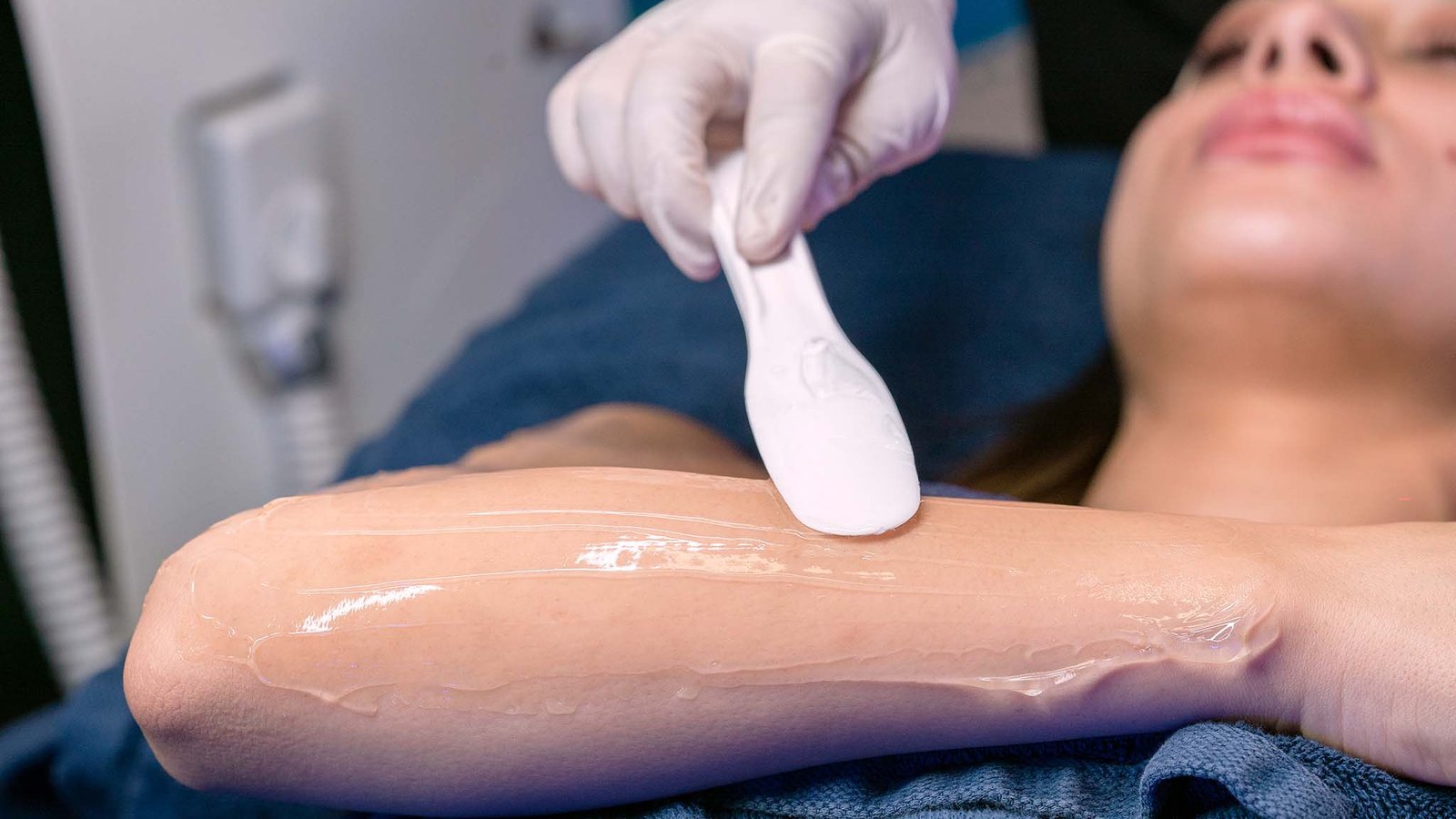 hair removal laser hair removal