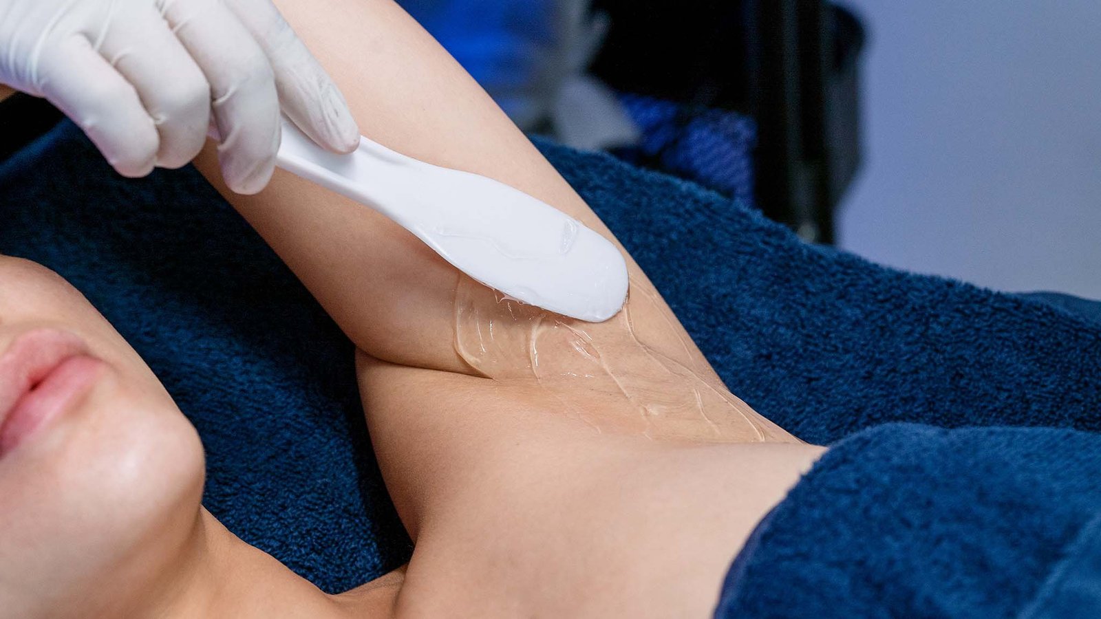 laser hair removal laser hair removal